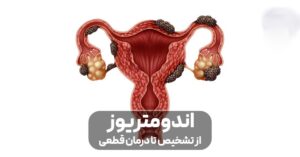 اندومتریوز چیست