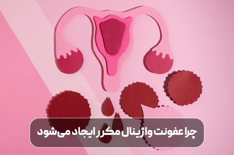 چرا عفونت واژینال مکرر ایجاد می‌شود و چگونه می‌توان آن را درمان کرد؟