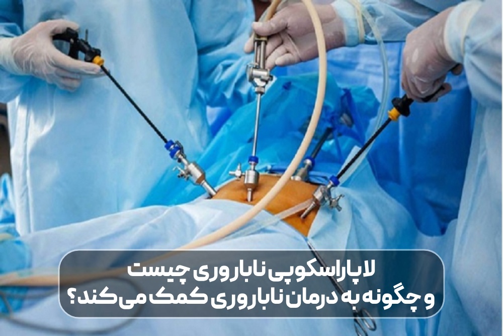 لاپاراسکوپی ناباروری چیست