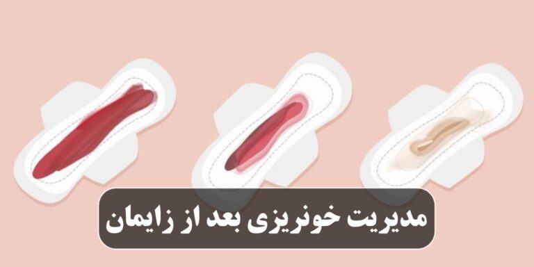 مدیریت خونریزی بعد از زایمان: نشانه‌ها، پیشگیری و درمان
