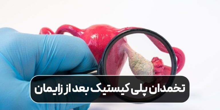 تخمدان پلی کیستیک بعد از زایمان: علل، پیامدها و نحوه کنترل