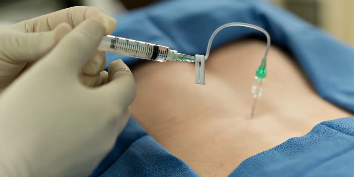 انتخاب نوع بیهوشی در زایمان