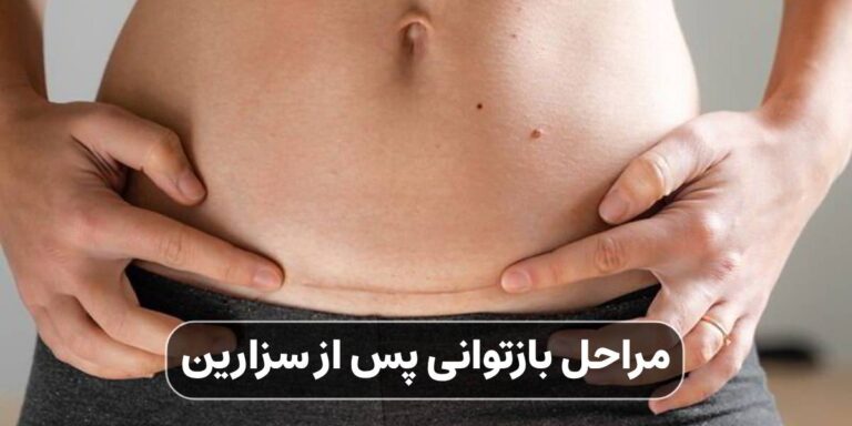 مراحل بازتوانی پس از سزارین: ورزش‌های مناسب، تغذیه و مراقبت روانی