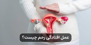عمل افتادگی رحم چیست