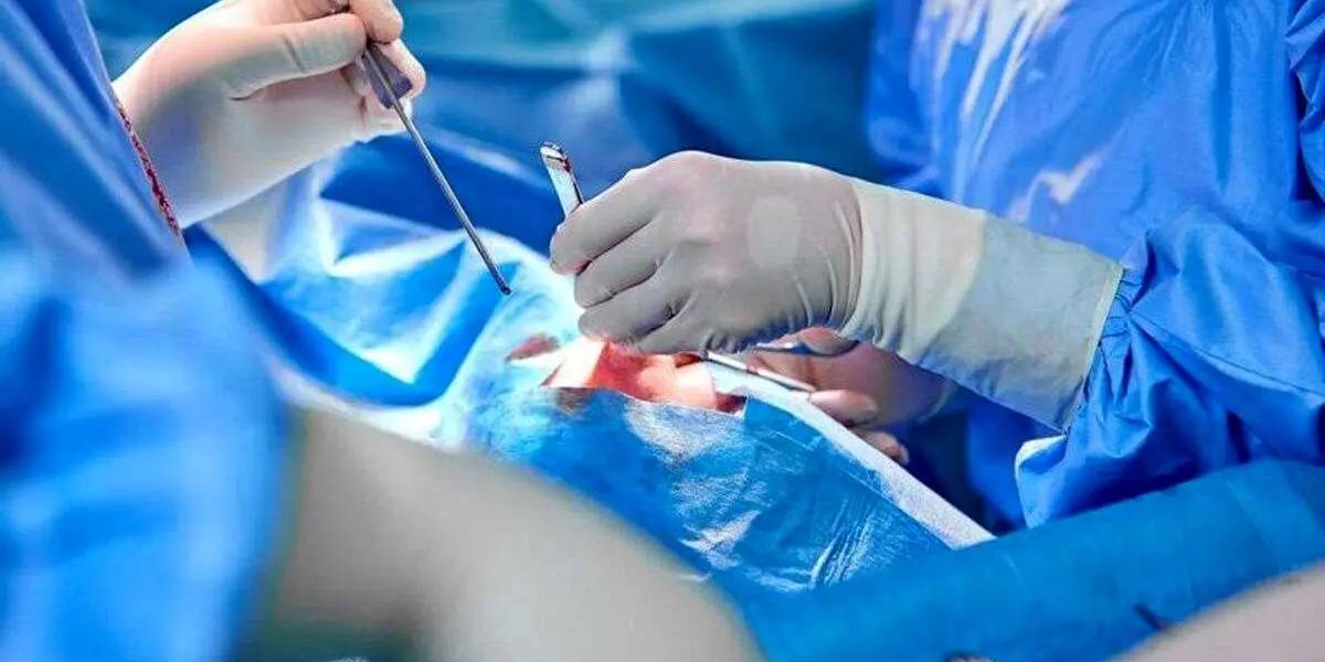 روش عمل افتادگی رحم چیست