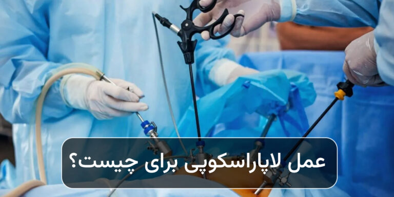 عمل لاپاراسکوپی برای چیست و چه مزایایی دارد؟