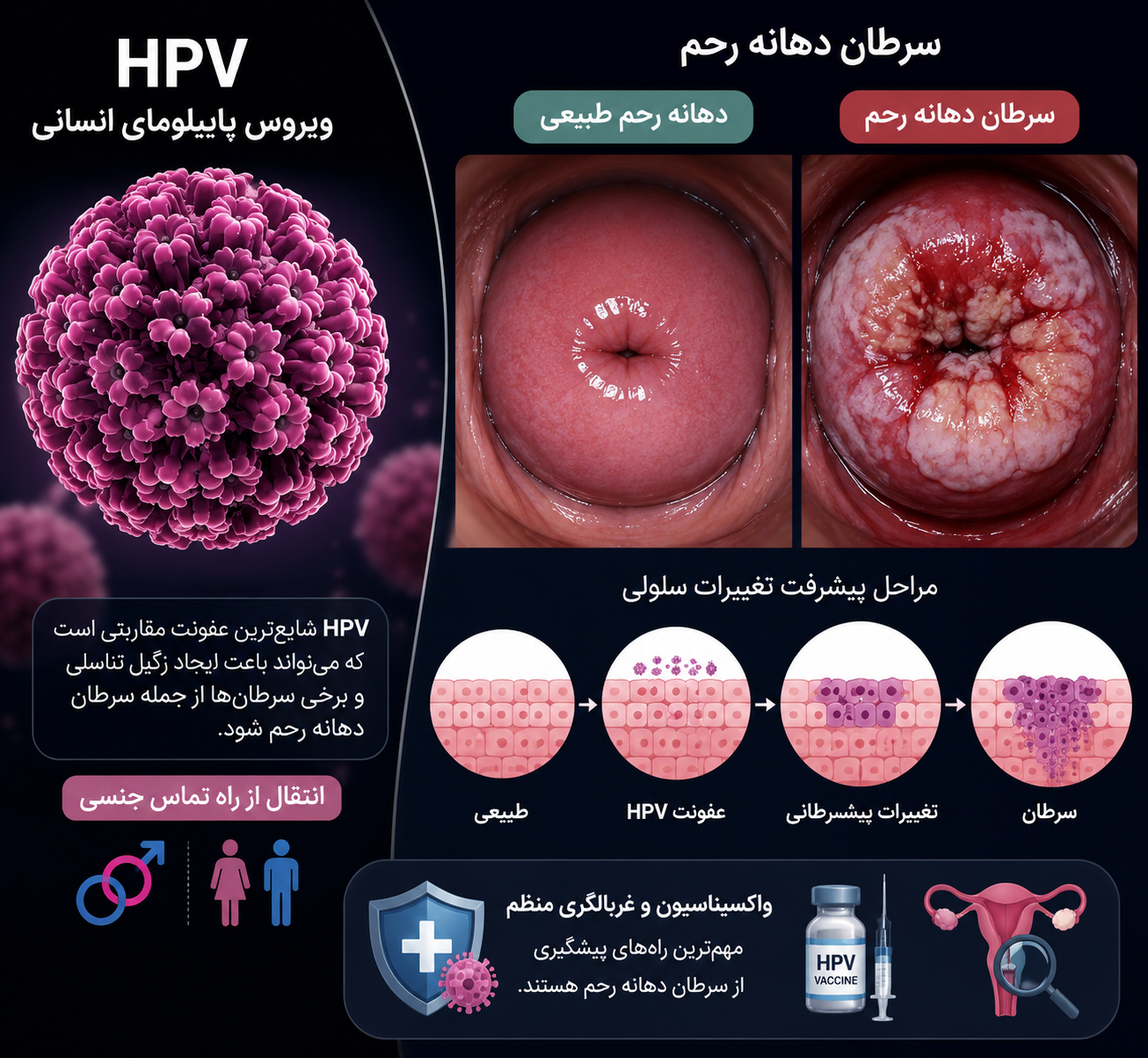 آیا HPV باعث سرطان دهانه رحم میشود