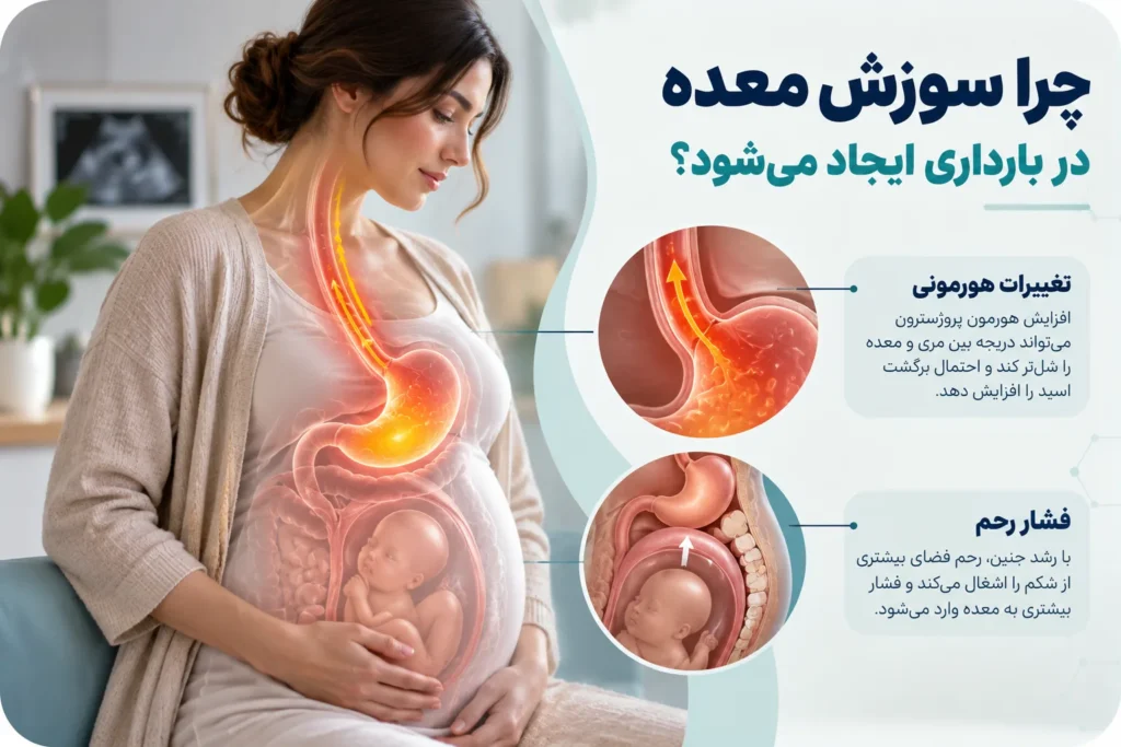 سوزش معده در بارداری؛ علت و راه‌های کنترل آن