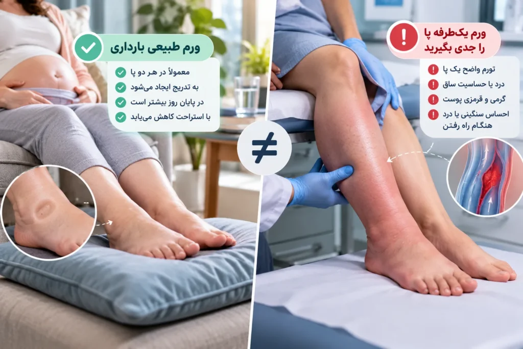 ورم پا در بارداری 